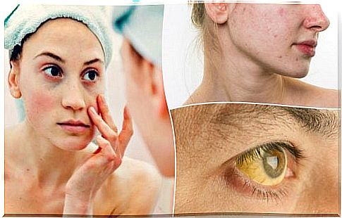 7 Signs of Nutritional Deficiencies in Your Face
