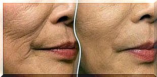 Exercises to train your facial muscles against wrinkle formation