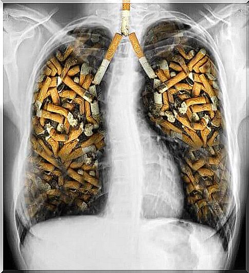 smoker's lungs
