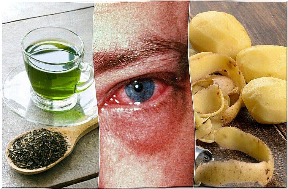The 8 best home remedies for an eye infection