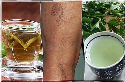 Treat varicose veins with these diuretic teas
