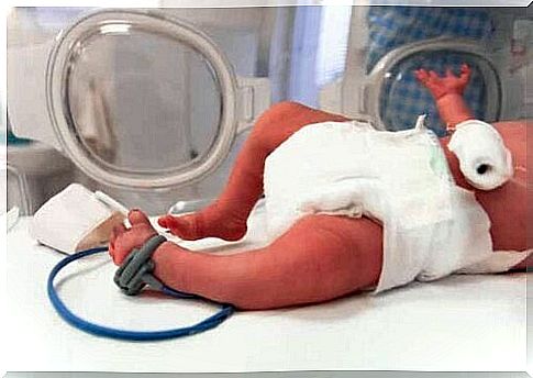 A premature baby