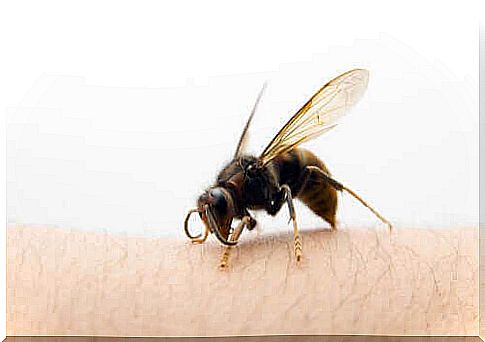 What to do after a Asian hornet sting